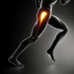 lower back pain, sciatic nerve pain, back pain ,nerve pain back pain, lower back pain